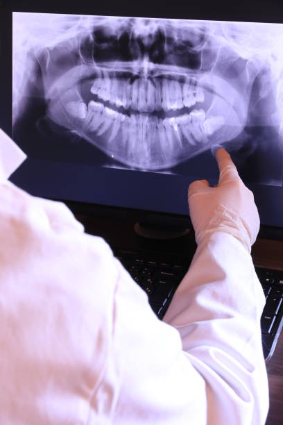 Best Weekend Emergency Dentist in Montgomery Village, MD