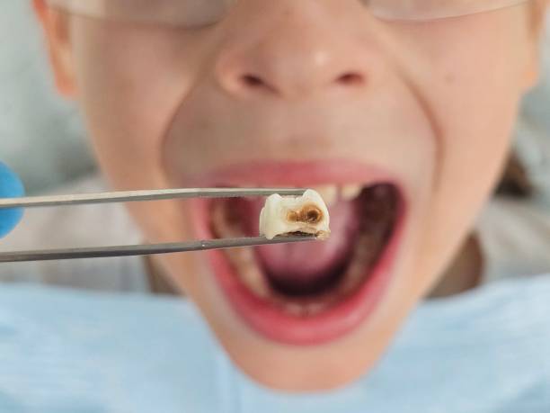 Best Pediatric Emergency Dentist in Montgomery Village, MD